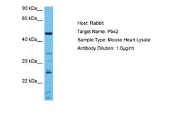 PBX2 Rabbit anti-Human, Mouse, Polyclonal, Novus Biologicals 0.1ml; Unconjugated:Antibodies,